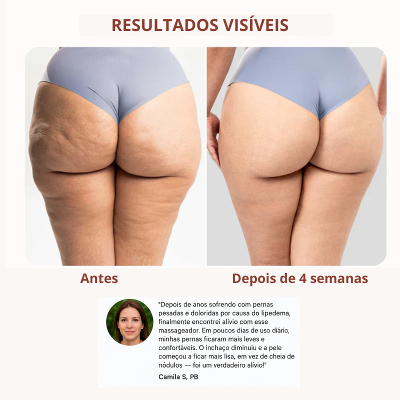 Lymfedrainage massageroller voor lipoedeem en cellulite