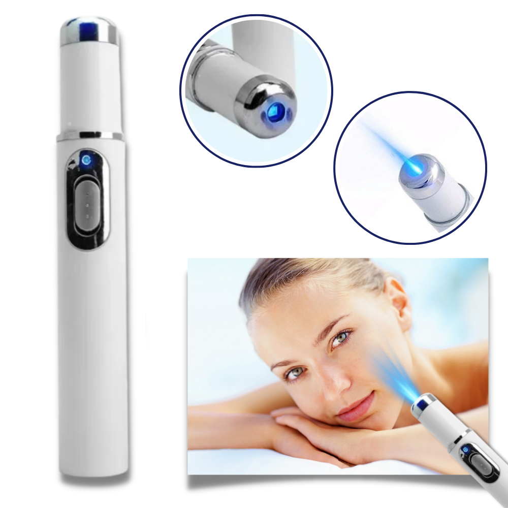 Blauwlicht-laserpen voor een zuiverdere huidteint