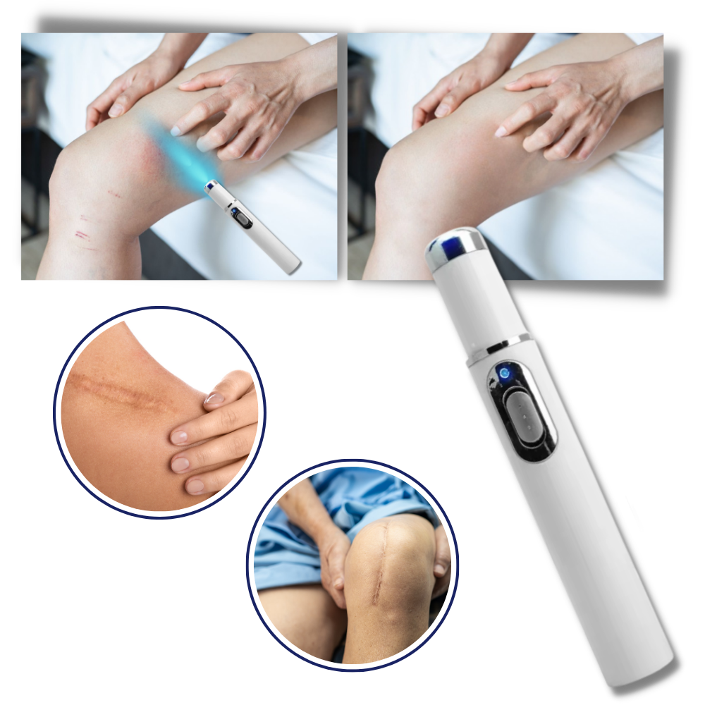 Blauwlicht-laserpen voor een zuiverdere huidteint