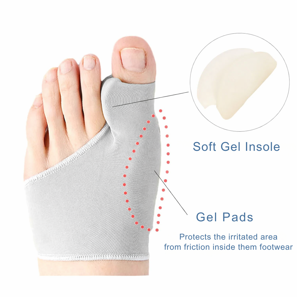 Hallux valgus - Tenencorrector - Drukverlichting tijdens het lopen